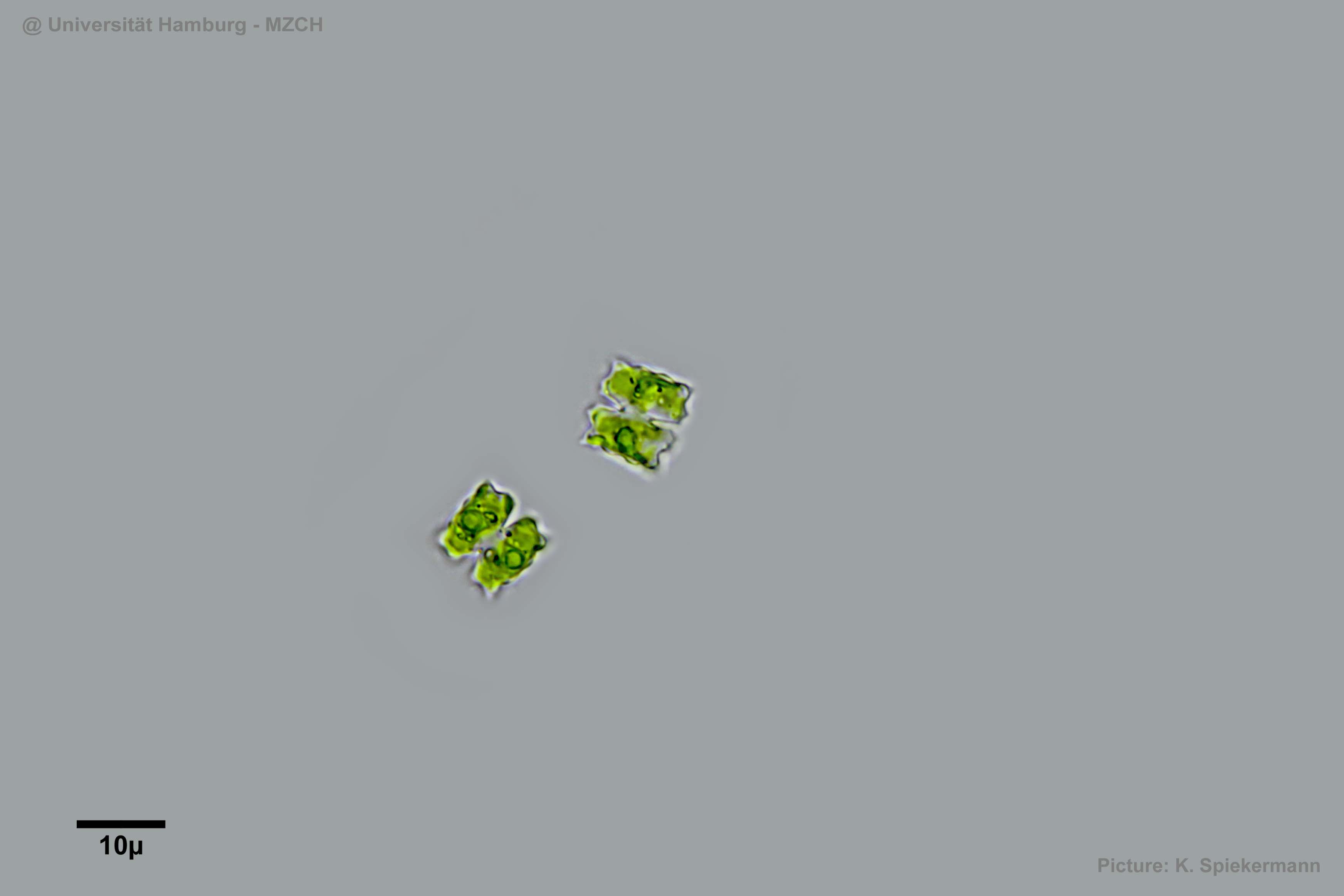 463_Cosmarium dilatatum_WH